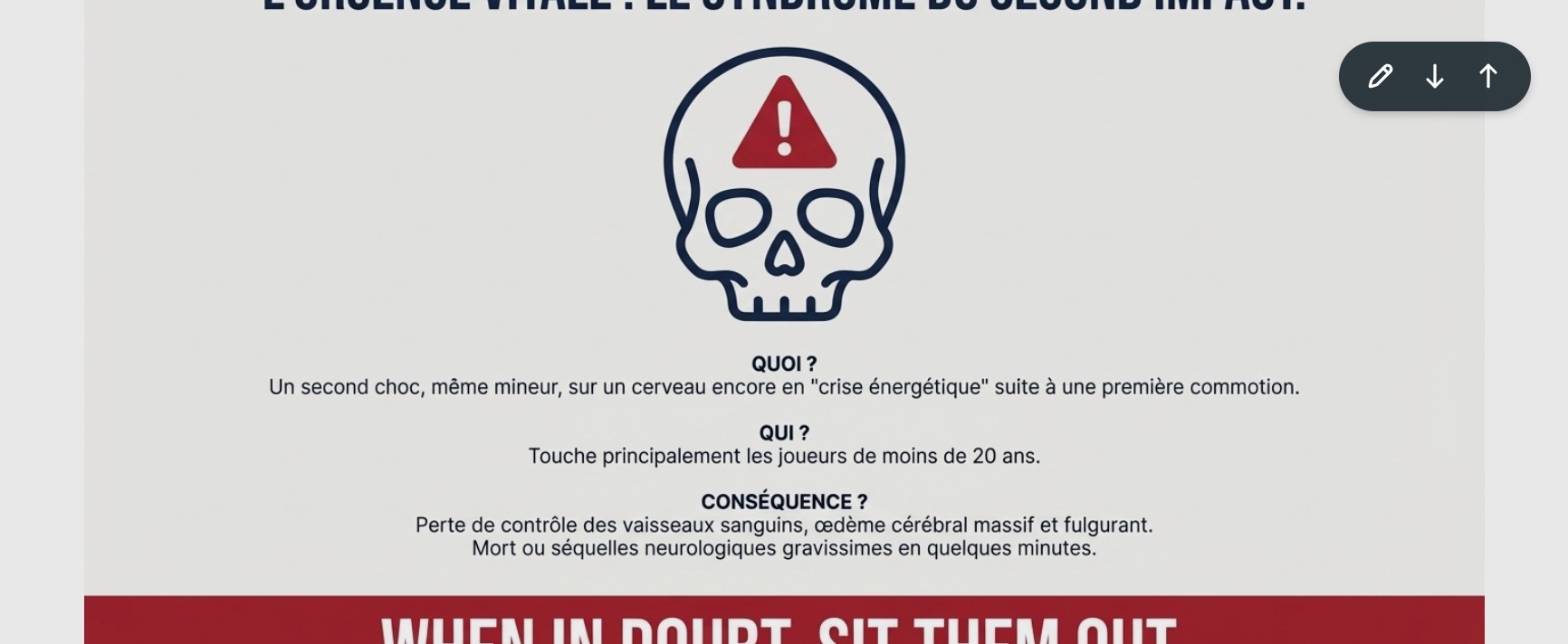 Syndrome du Second Impact : crâne + WHEN IN DOUBT SIT THEM OUT