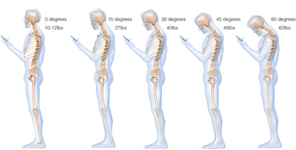 Diagramme montrant la charge sur le rachis cervical à 0°, 15°, 30°, 45° et 60° de flexion